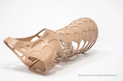 3D printed arm orthosis