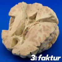 3D-printed medical training model of the brain